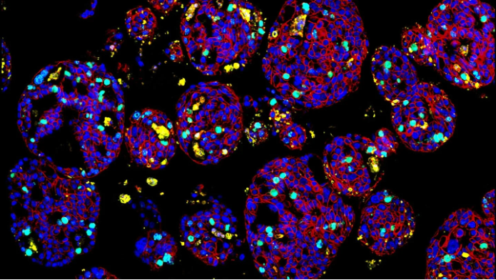 MD Anderson, Xilis collaborate for accelerated cancer therapy dev.