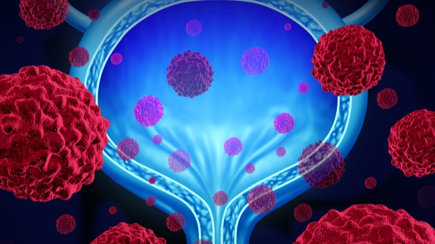 ImmunityBio’s Bladder Cancer Immunotherapy gets an FDA Approval