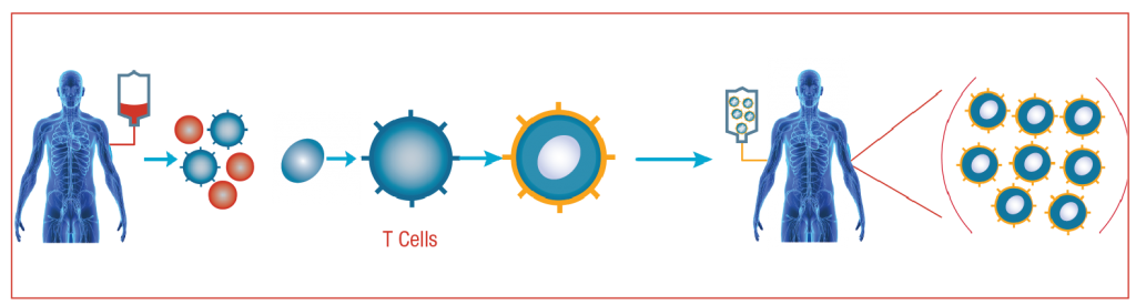 Process of CAR T-Cell Therapy - Ingenious e-Brain