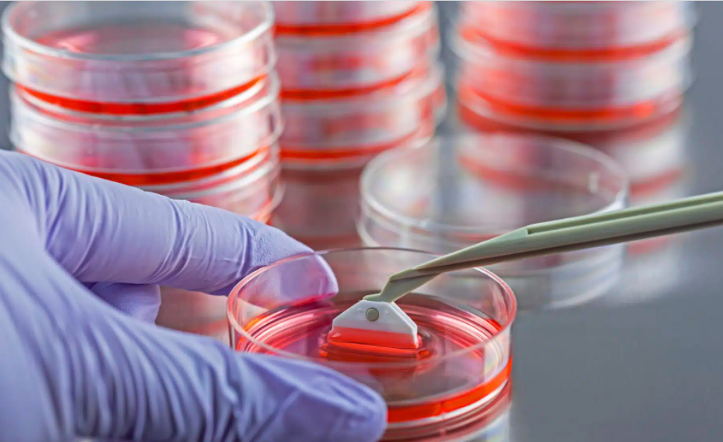 Ryne Bio focuses on cell transplantation for Parkinson’s