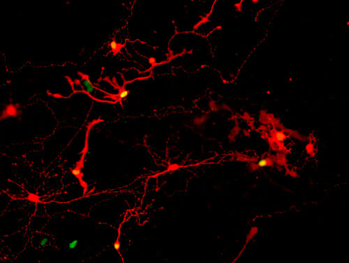Lab-grown Retinas for Vision Loss Disease