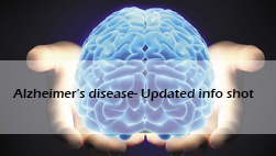 IeB Insights: Alzheimer’s disease