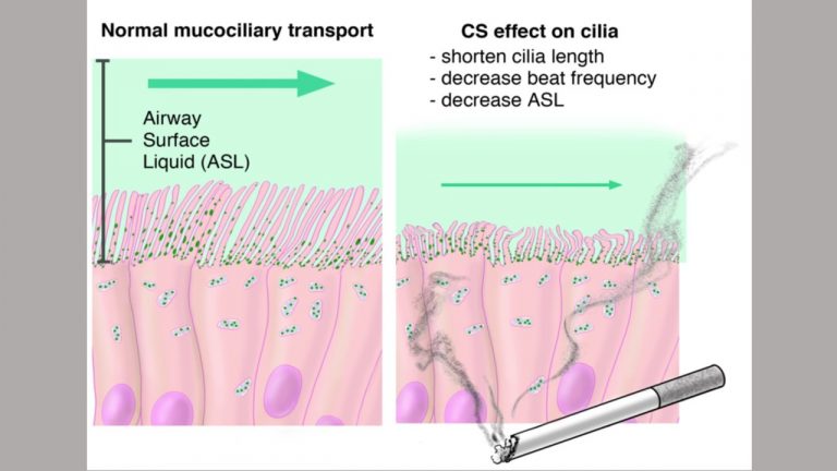 Amoeba Biology: Promising Lung Disease Treatment Target