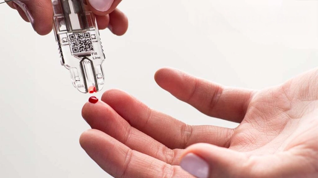 Tap into Mexico’s POC Diagnostics Market for Pancreatic Cancer – Act Fast, As the Market is Gaining Momentum!